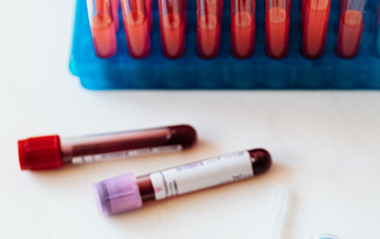 血HCG检测