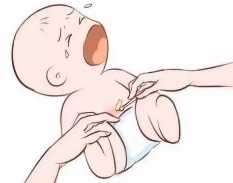 脐带护理
