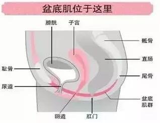 盆底功能障碍性