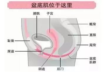 中国盆底之父