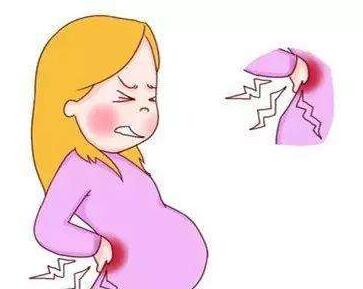 孕期腰痛